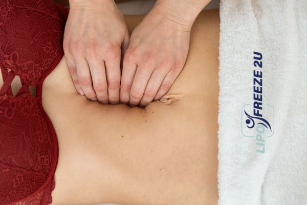 diastasis recti treatment Brighton and Hove