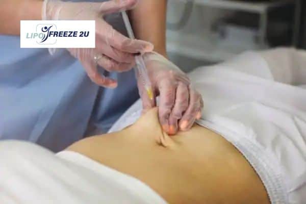 Fat Dissolving Injections Brighton and Hove & Weight loss medication