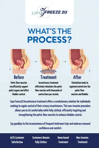 Diagram of how incontinence treatment Brighton and Hove works.