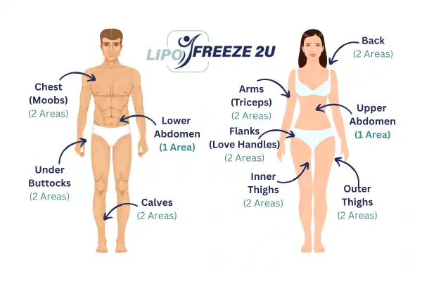 Areas you can have fat freezing treatment Brighton and Hove