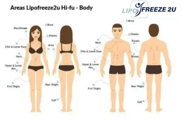 image of areas of the body and HIFU prices Brighton and Hove