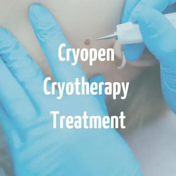 Cryopen Cryotherapy Treatment Brighton and Hove