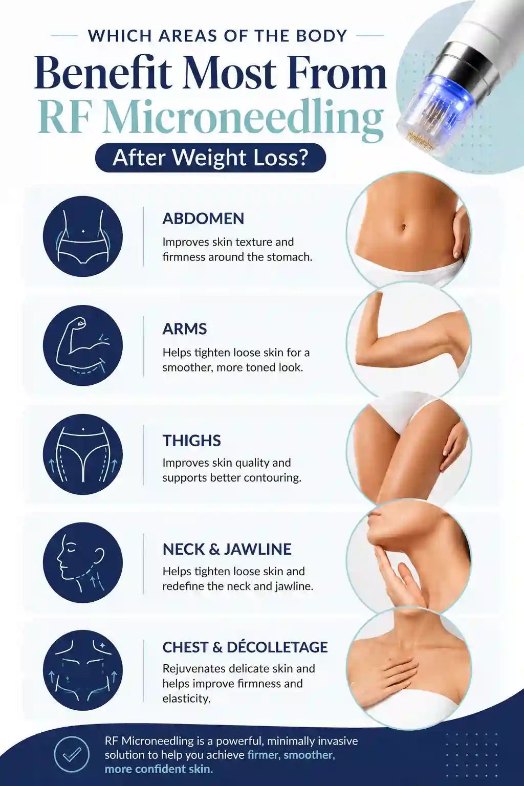 Which Areas of the Body Benefit Most From RF Microneedling After Weight Loss Brighton and Hove