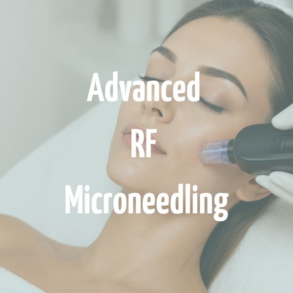 Advanced RF Microneedling Brighton and Hove